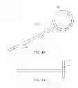 Fig. 07 - Helical balloon catheter