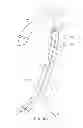 Fig. 09 - Helical balloon catheter