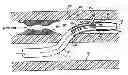 Fig. 01 - Systems and Methods for Delivering Drugs to Selected Locations Within the Body