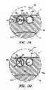 Fig. 06 - Systems and Methods for Delivering Drugs to Selected Locations Within the Body