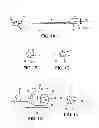 Fig. 02 - CATHETER APPARATUS AND METHODS FOR TREATING VASCULATURES