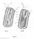 Fig. 02 - METHOD AND APPARATUS FOR ELIMINATING ATHEROSCLEROSIS FROM A REGION OF THE ARTERIAL TREE