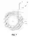 Fig. 07 - CERCLAGE WIRE INSERTION DEVICE