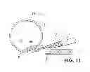 Fig. 09 - CERCLAGE WIRE INSERTION DEVICE
