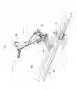 Fig. 02 - TOOL WITH BIOABSORBABLE MATERIAL FOR INTRAOPERATIVE USE