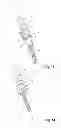 Fig. 06 - Instrument for inserting a bone anchoring element and system of such an instrument and a polyaxial bone anchoring element