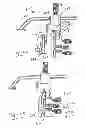 Fig. 07 - Bony balancing apparatus and method for total knee replacement