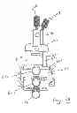 Fig. 08 - Bony balancing apparatus and method for total knee replacement