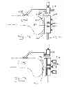 Fig. 09 - Bony balancing apparatus and method for total knee replacement
