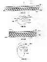 Fig. 07 - Phacoemulsification Needle