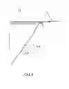 Fig. 09 - Tissue retrieval system