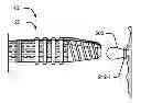 Fig. 01 - Ligation band dispensing cap assembly and methods of use