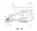 Fig. 83 - THUMBWHEEL SWITCH ARRANGEMENTS FOR SURGICAL INSTRUMENTS