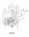 Fig. 03 - SYSTEMS AND METHODS FOR TREATMENT OF COMPRESSED NERVES