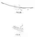 Fig. 10 - SYSTEMS AND METHODS FOR TREATMENT OF COMPRESSED NERVES