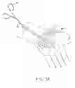 Fig. 34 - SYSTEMS AND METHODS FOR TREATMENT OF COMPRESSED NERVES