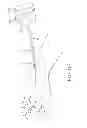 Fig. 52 - SYSTEMS AND METHODS FOR TREATMENT OF COMPRESSED NERVES