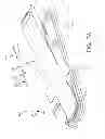Fig. 58 - SYSTEMS AND METHODS FOR TREATMENT OF COMPRESSED NERVES