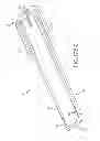 Fig. 60 - SYSTEMS AND METHODS FOR TREATMENT OF COMPRESSED NERVES