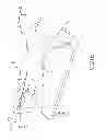 Fig. 97 - SYSTEMS AND METHODS FOR TREATMENT OF COMPRESSED NERVES