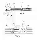 Fig. 06 - Laparoscopic scissors