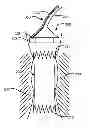 Fig. 01 - Methods of repositioning a transcatheter heart valve after full deployment