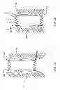 Fig. 03 - Methods of repositioning a transcatheter heart valve after full deployment