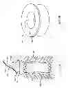 Fig. 04 - Methods of repositioning a transcatheter heart valve after full deployment