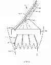 Fig. 06 - Methods of repositioning a transcatheter heart valve after full deployment