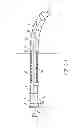 Fig. 02 - Catheter with occluding cuff