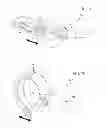 Fig. 11 - METHODS AND DEVICES FOR OCCLUDING BLOOD FLOW TO AN ORGAN