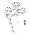 Fig. 16 - LAPAROSCOPIC INSTRUMENT AND RELATED SURGICAL METHOD