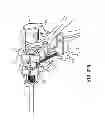 Fig. 17 - LAPAROSCOPIC INSTRUMENT AND RELATED SURGICAL METHOD