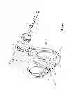 Fig. 25 - LAPAROSCOPIC INSTRUMENT AND RELATED SURGICAL METHOD