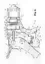 Fig. 27 - LAPAROSCOPIC INSTRUMENT AND RELATED SURGICAL METHOD