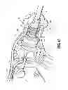Fig. 28 - LAPAROSCOPIC INSTRUMENT AND RELATED SURGICAL METHOD
