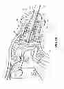 Fig. 29 - LAPAROSCOPIC INSTRUMENT AND RELATED SURGICAL METHOD