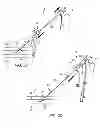 Fig. 07 - Apparatus and methods for sealing a vascular puncture