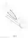 Fig. 04 - Knotless filamentary fixation devices, assemblies and systems and methods of assembly and use