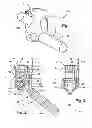 Fig. 02 - Polyaxial bone anchors with increased angulation