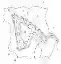Fig. 01 - Pelvic bone plate