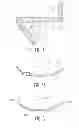 Fig. 03 - Pelvic bone plate