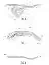 Fig. 04 - Pelvic bone plate