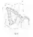 Fig. 07 - Pelvic bone plate