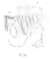 Fig. 09 - Pelvic bone plate