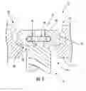 Fig. 06 - Medical device locking mechanisms and related methods and systems
