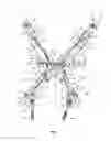 Fig. 02 - Spinal correction system and method