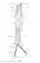 Fig. 04 - Spinal correction system and method