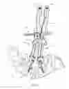Fig. 06 - Spinal correction system and method