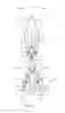 Fig. 11 - Spinal correction system and method